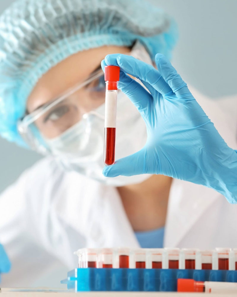آزمایش hpv تهران و معرفی آزمایشگاه نیل به عنوان بهترین آزمایشگاه آزمایش hpv تهران و هزینه تست hpv مردان و تفسیر آزمایش hpv با نوبت دهی آنلاین و سریع هزینه آزمایش hpv سال آزمایش hpv مردان آزمایش hpv چگونه انجام میشود تفسیر آزمایش hpv برای آزمایش hpv باید ناشتا بود؟ آزمایش hpv مردان آزمایش رایگان hpv جواب آزمایش hpv چقدر طول می کشد - راهنمای انتخاب بهترین مرکز برای تست HPV در تهران