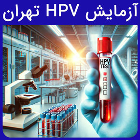 آزمایش hpv تهران و معرفی آزمایشگاه نیل به عنوان بهترین آزمایشگاه آزمایش hpv تهران و هزینه تست hpv مردان و تفسیر آزمایش hpv با نوبت دهی آنلاین و سریع هزینه آزمایش hpv سال آزمایش hpv مردان آزمایش hpv چگونه انجام میشود تفسیر آزمایش hpv برای آزمایش hpv باید ناشتا بود؟ آزمایش hpv مردان آزمایش رایگان hpv جواب آزمایش hpv چقدر طول می کشد