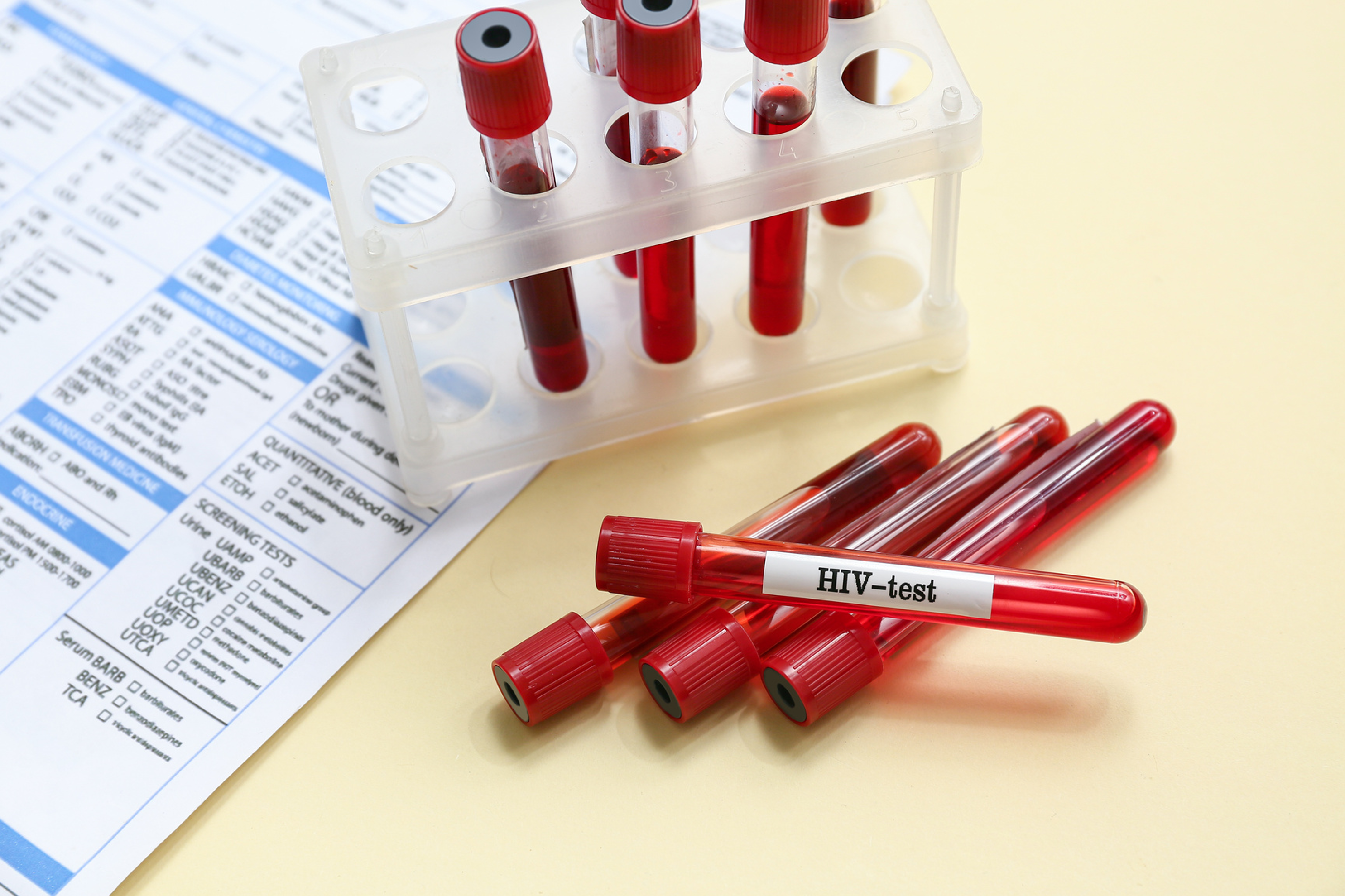 هفته طلایی برای انجام تست HIV – آزمایشگاه نیل، دقیق و مطمئن